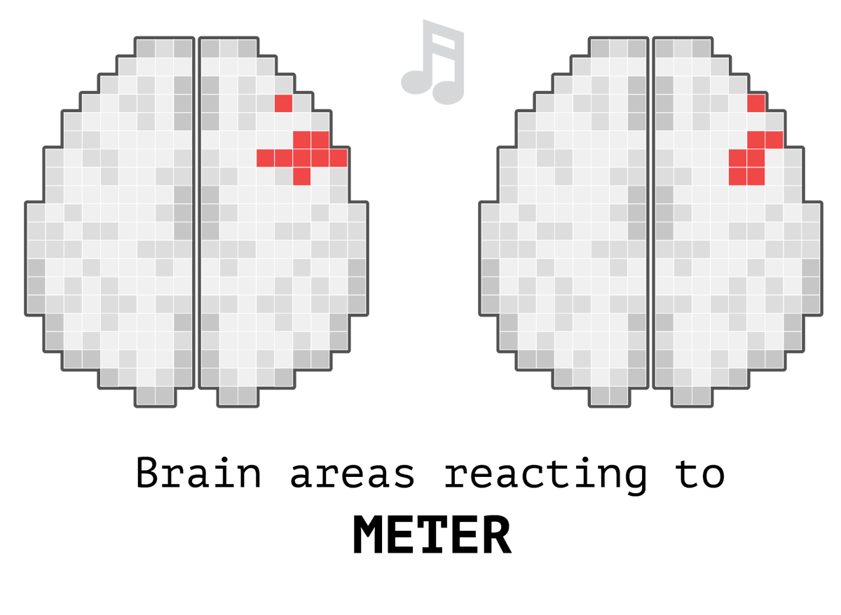 brain activity while listening to rhythm patterns, tempo and meter